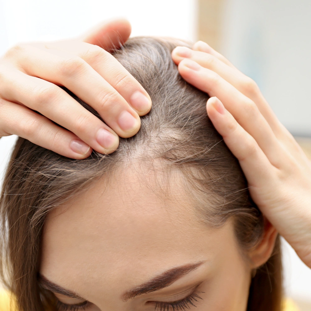 Hair Loss & Hair Thinning