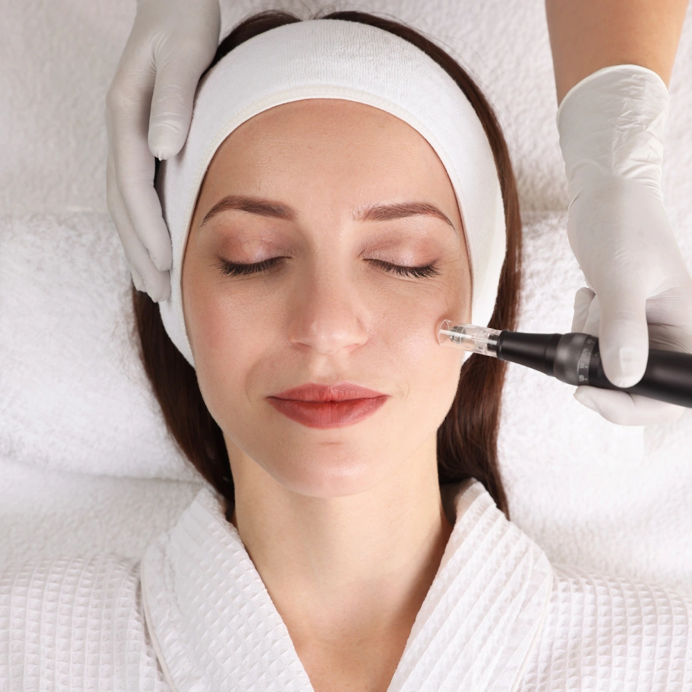 Microneedling